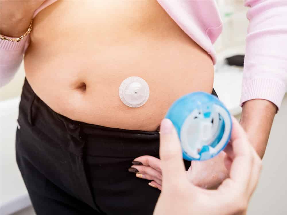 Diálisis peritoneal